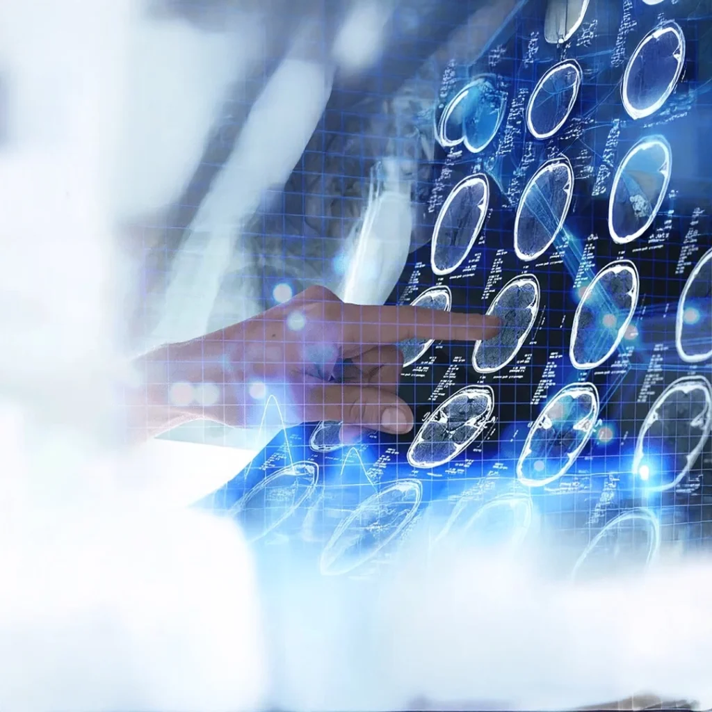 Interventional Radiology