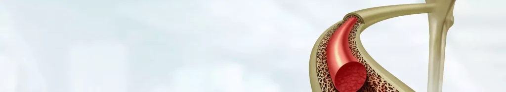 Bone Marrow Transplant Unit – Adult