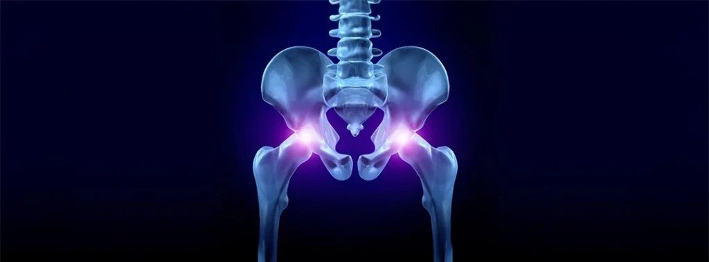 Hip Replacement Surgery: Recovery, Types, and Details