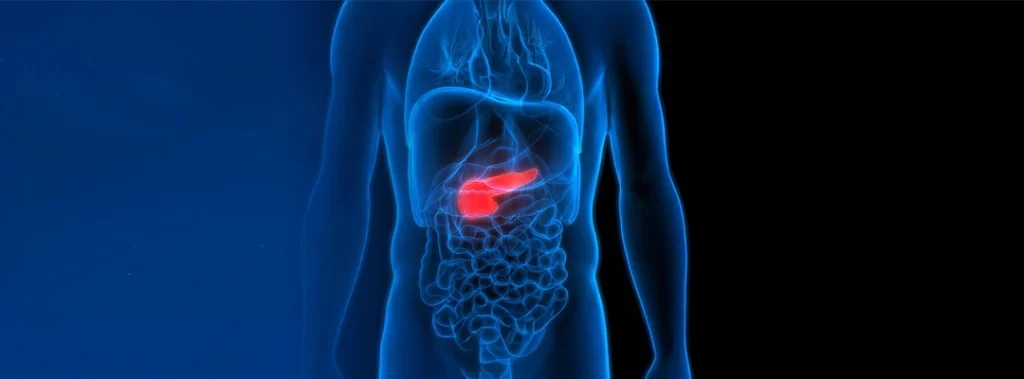 Modern Solutions in Treating Chronic Pancreatitis