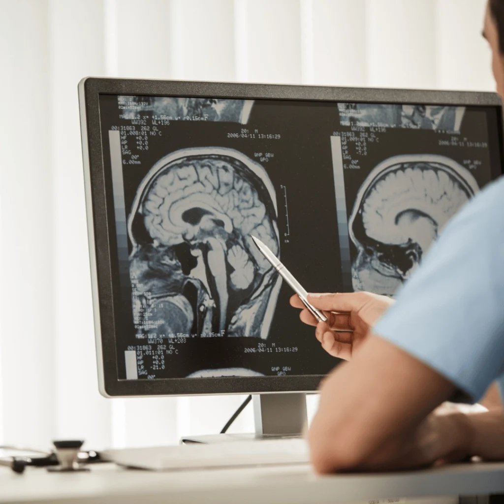 Awake Craniotomy: A Revolutionary Approach to Brain Tumor Surgery