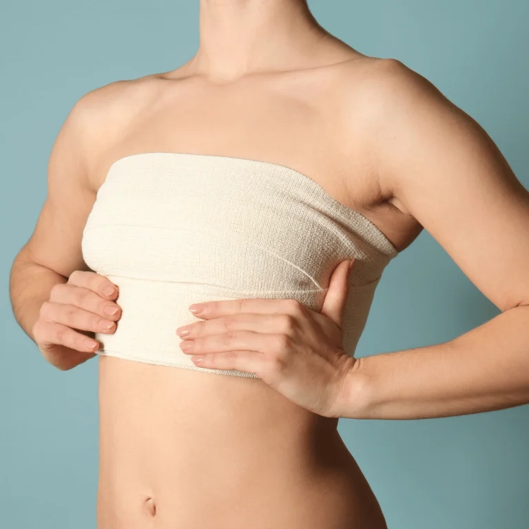 Hybrid Breast Augmentation: Combining Implants with Fat Transfer for Natural Cleavage