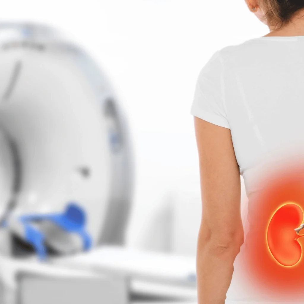 Kidney Scans or Biopsy: When to Consider Kidney Scans or Biopsy