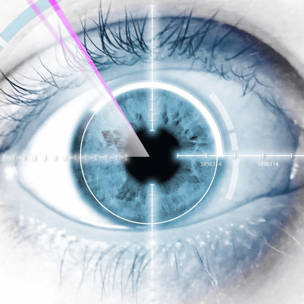 LASIK Surgery: What Is LASIK Surgery and How It Transforms Vision?