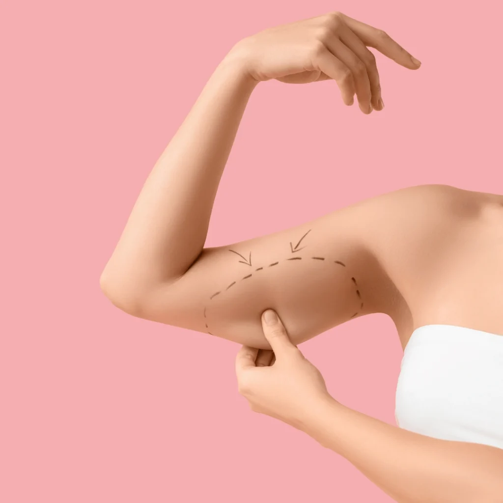 Arm Lift Turkey: Procedure Overview and Benefits