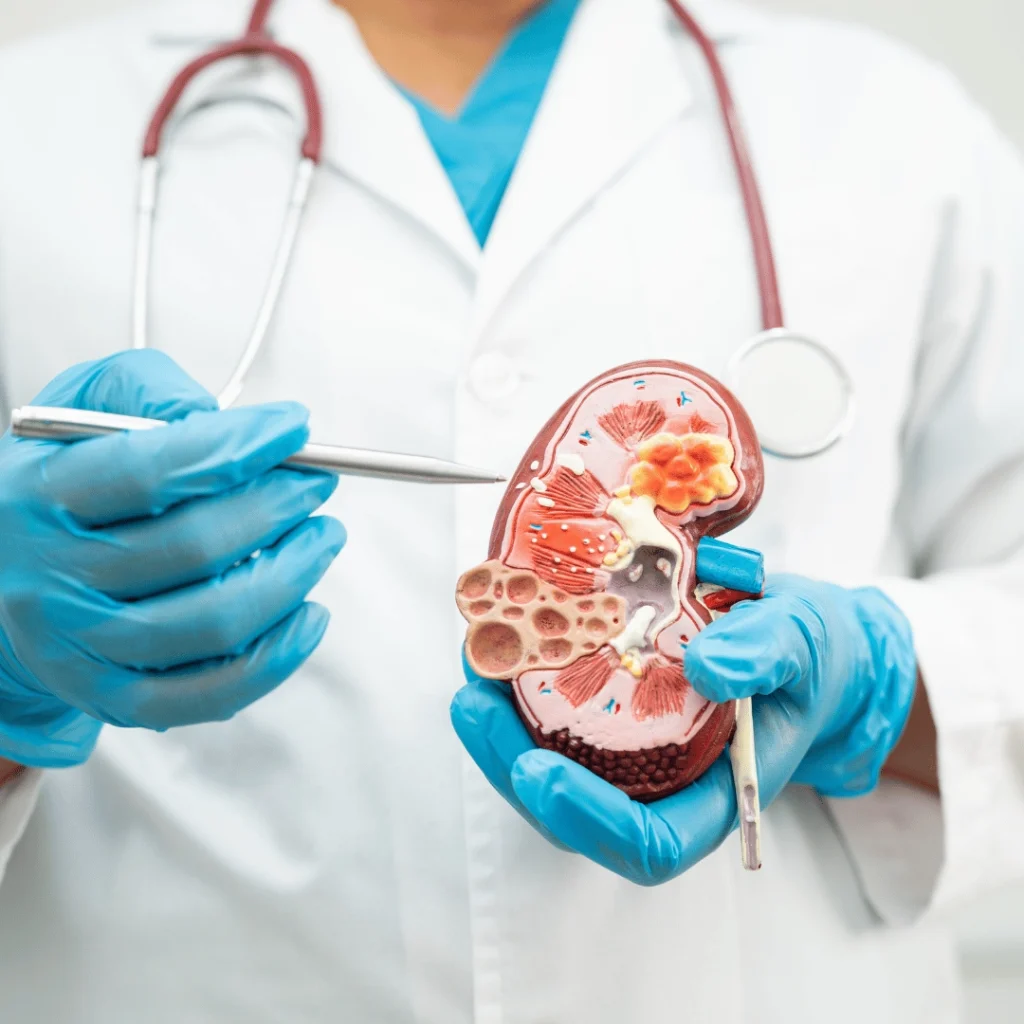 Kidney Cancer Symptoms and Treatment Methods