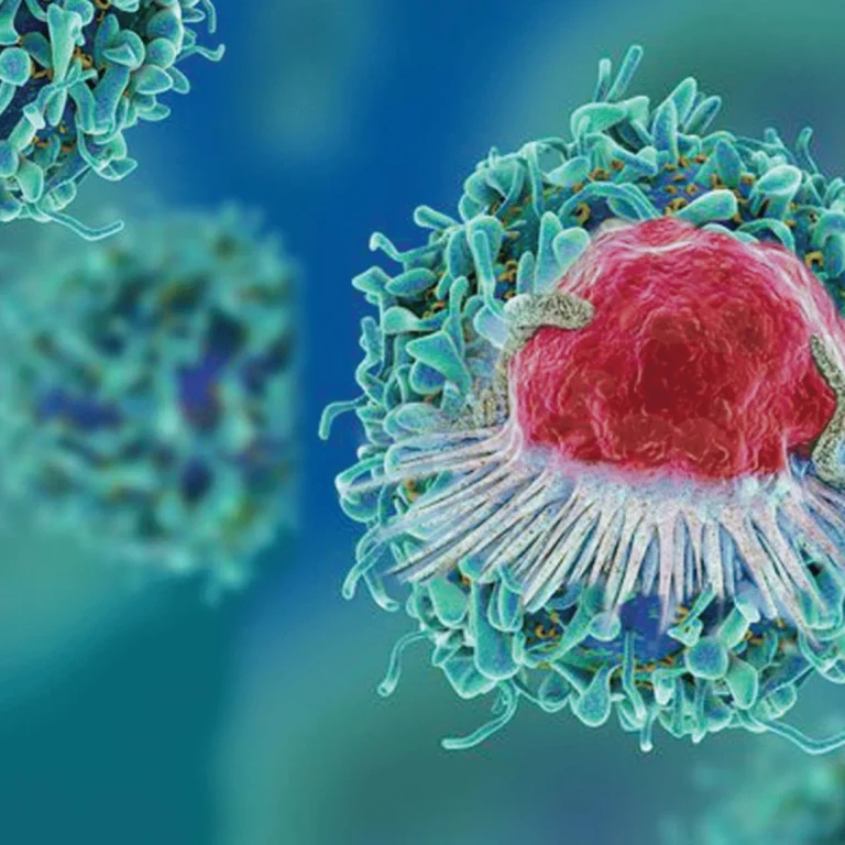 Symptoms and Treatment Methods of Lymph (Lymphoma) Cancer