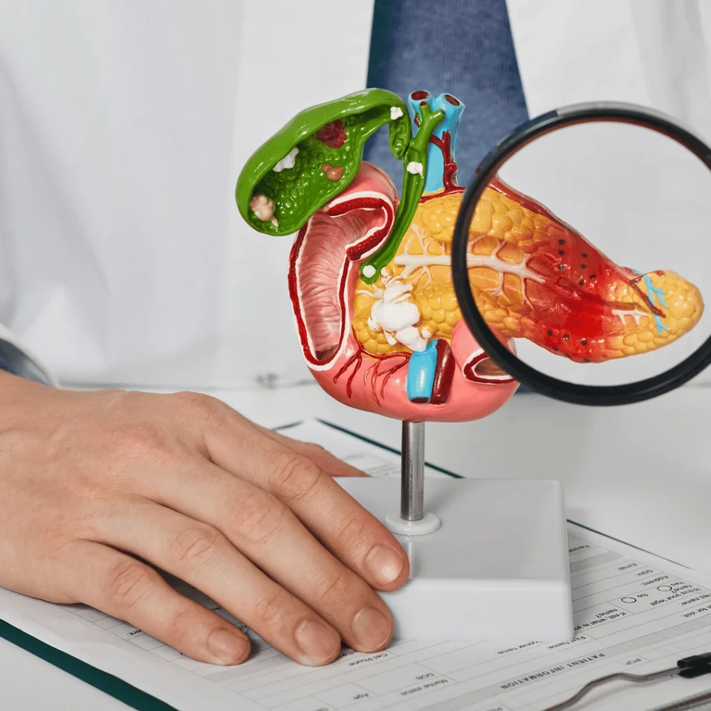 What is Pancreatic Cancer? Symptoms and Treatment Methods of Pancreatic Cancer