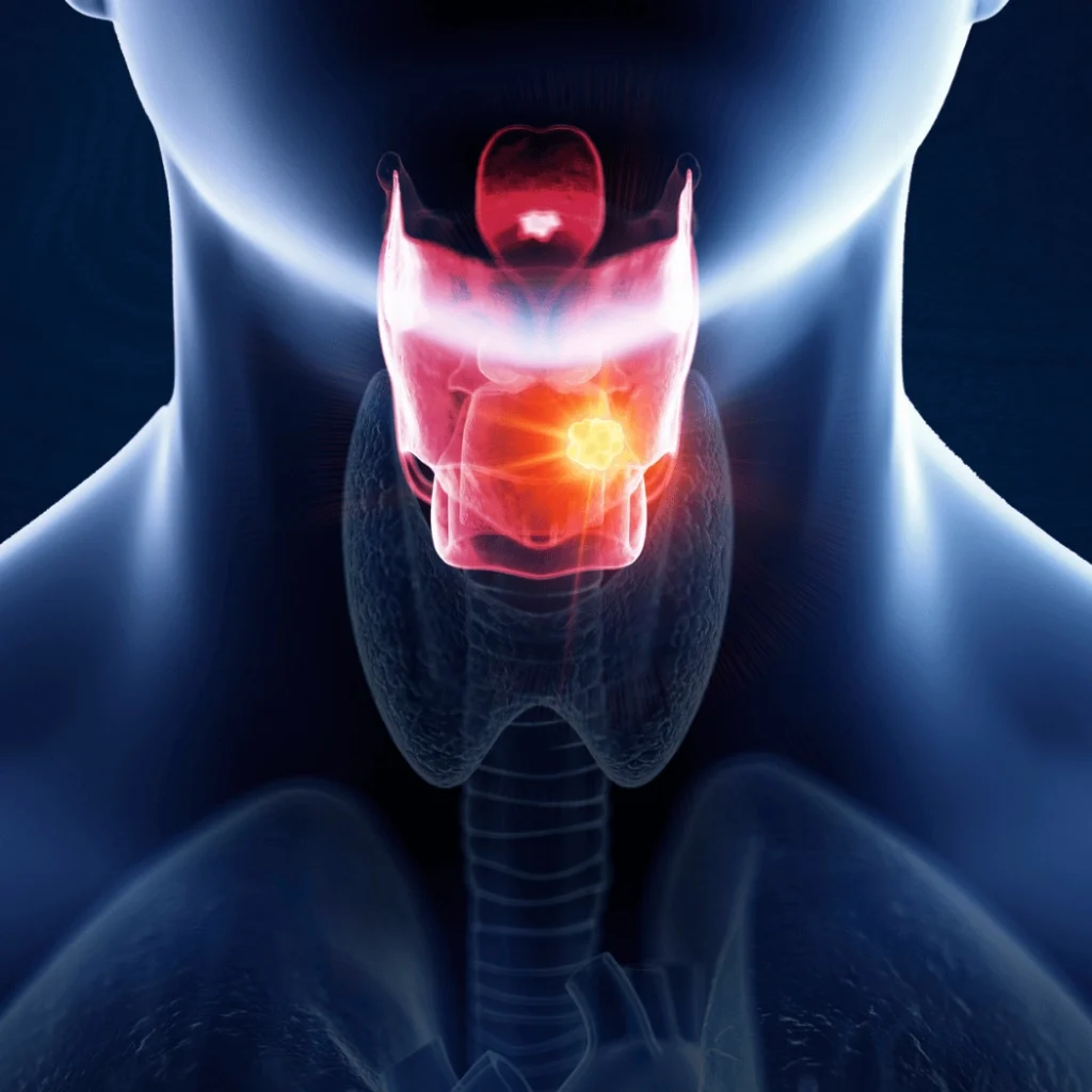 What is Laryngeal Cancer? Treatment of Laryngeal Cancer?