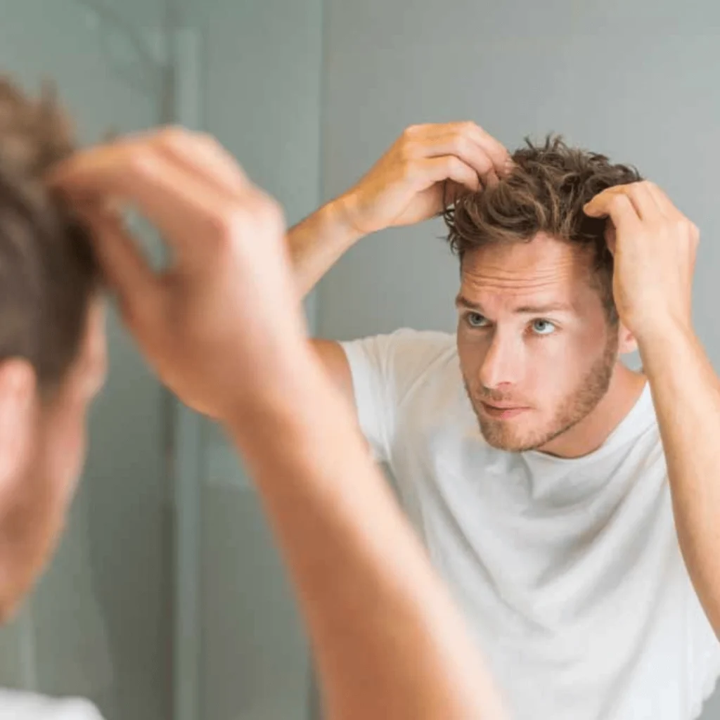 Why Do I Have a Receding Hairline?