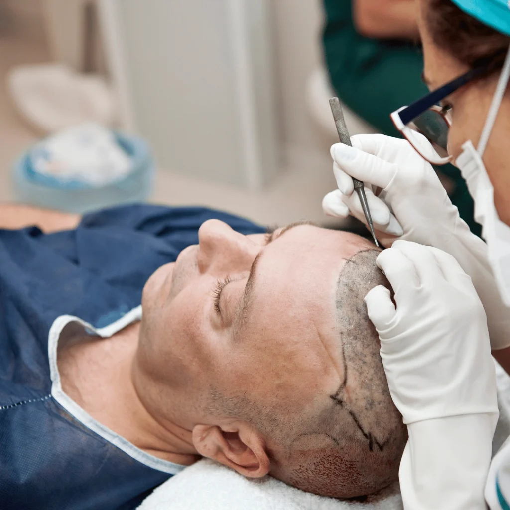 Dhi Hair Transplant