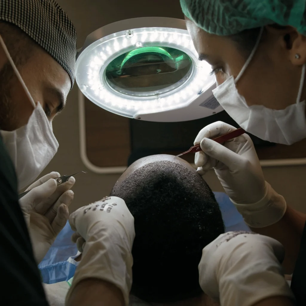 Fue Hair Transplant