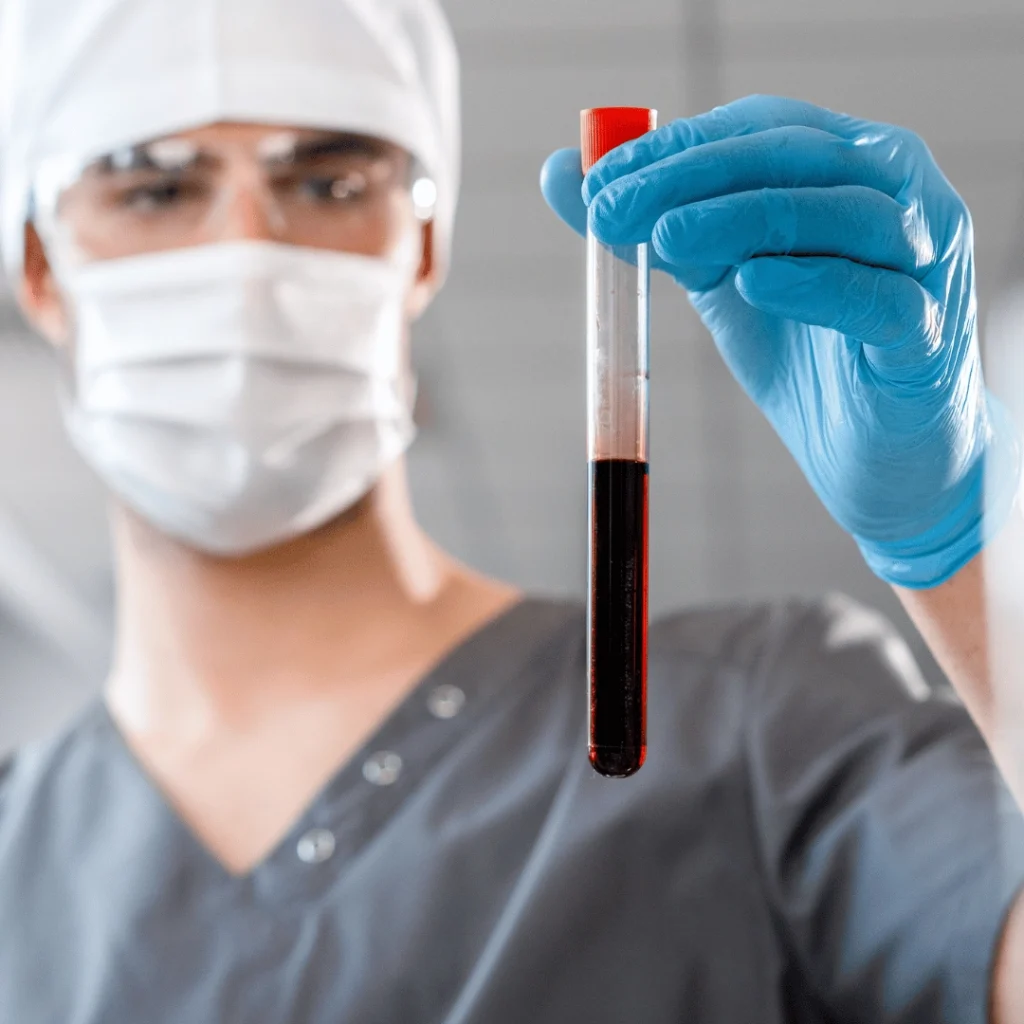 What is Bilirubin? What Does High and Low Bilirubin Mean?