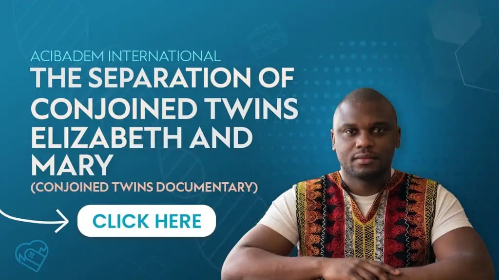 The Separation of Conjoined Twins Elizabeth and Mary