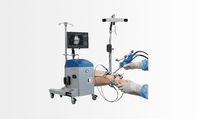 navio knee robot